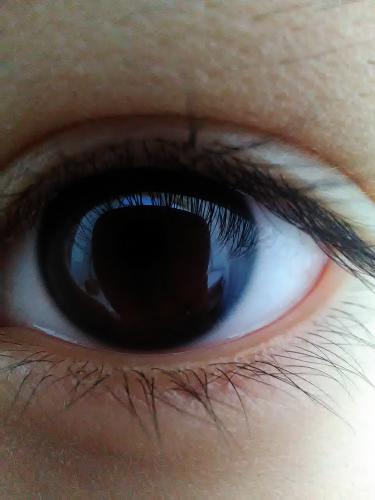 My eye